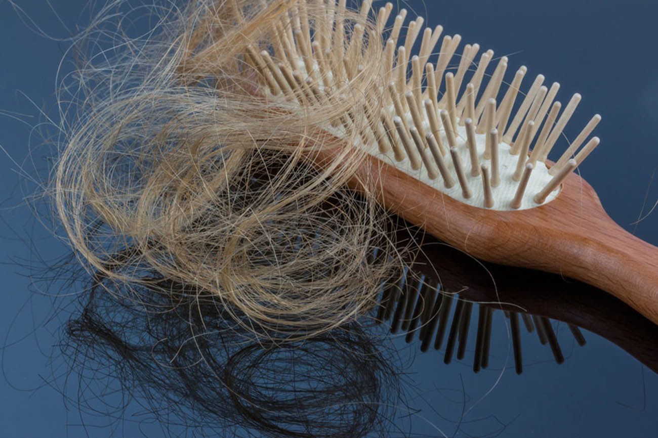 Let Your Hair Speak Up, part 9. Thinning Hair Care